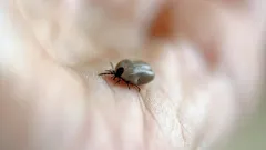 Krpelj na koži: što učiniti i kamo se obratiti nakon ugriza